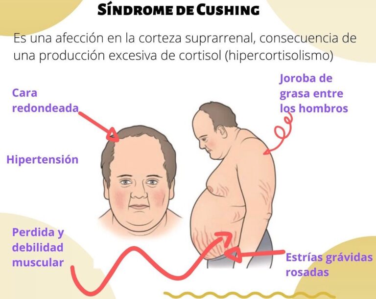 Síndrome De Cushing ¿me Está Pasando A Mí Salud Diez