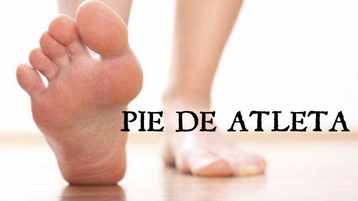 Pie De Atleta Te Explicamos Como Prevenirlo Salud Diez 9957